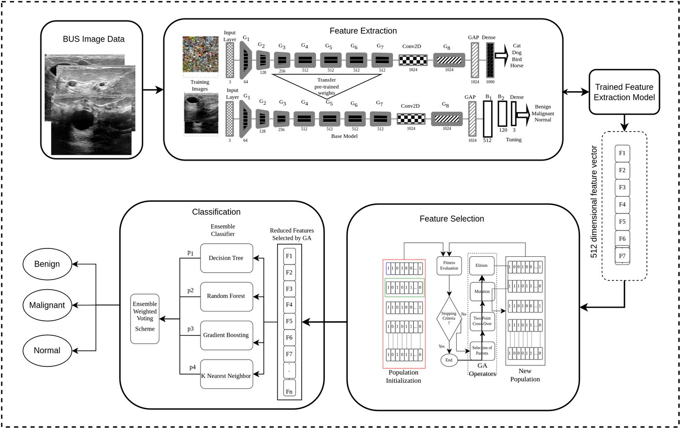 Architecture diagram — Deep learning and genetic algorithm-based ensemble model for feature selection and classification of breast ultrasound images