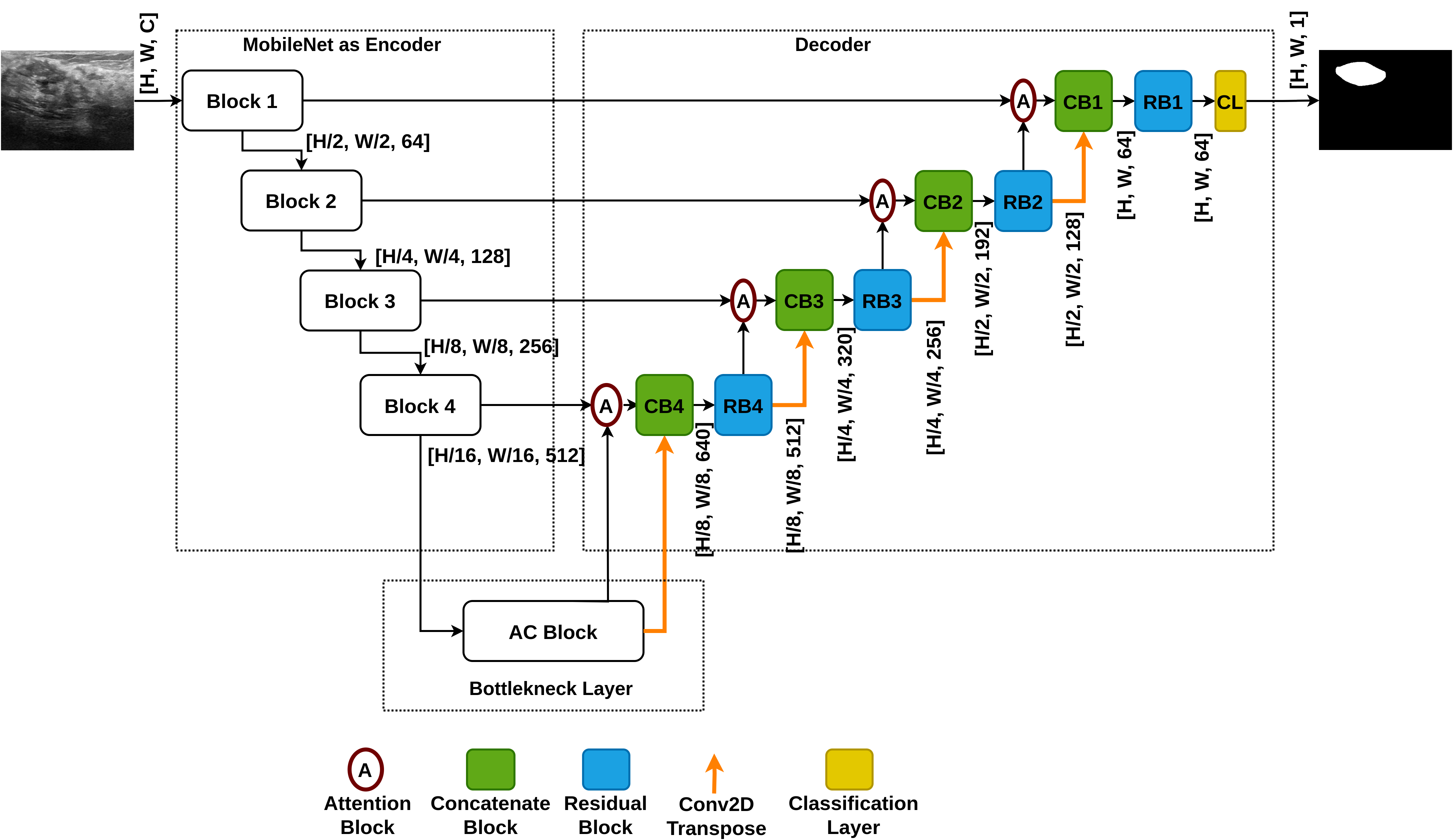 UMA-Net for Breast Ultrasound Segmentation screenshot